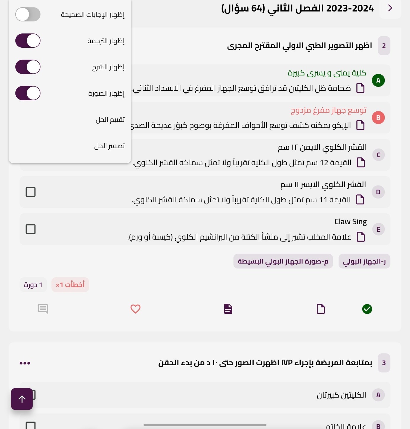 إعدادات عرض السؤال السريعة